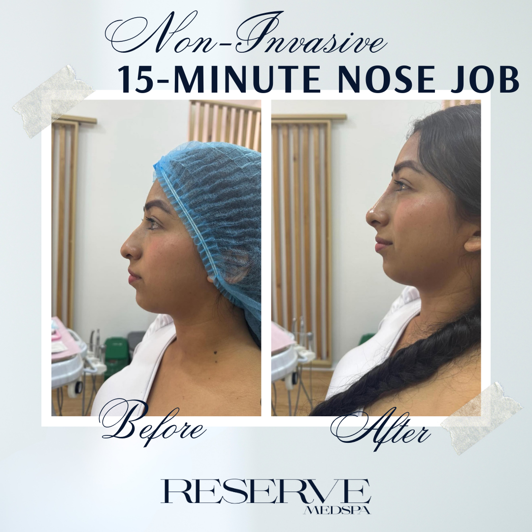 Facial balancing 2