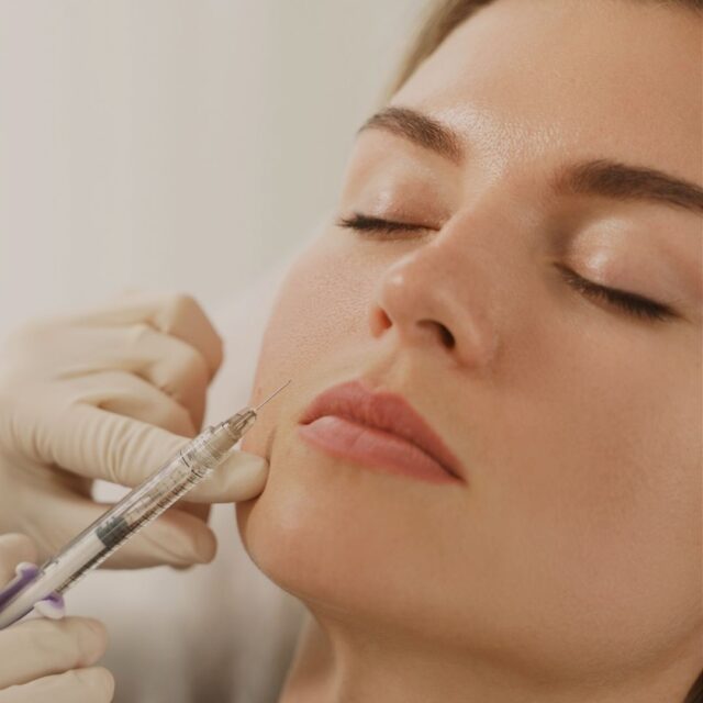 dermal fillers
